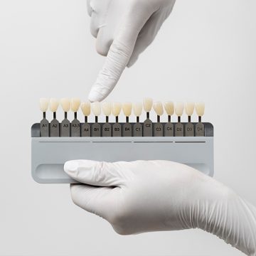 Are Dental Veneers Worth It? Expert Insights from Liberty Hill, TX Dentists