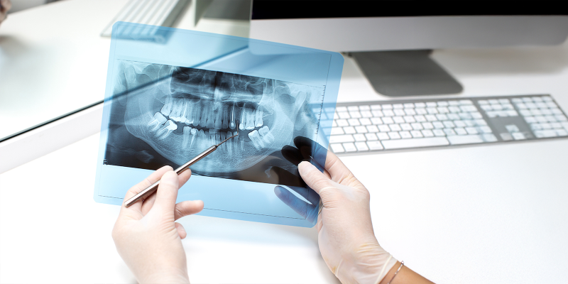 Complete Dental Exam & X-Rays for Just $99