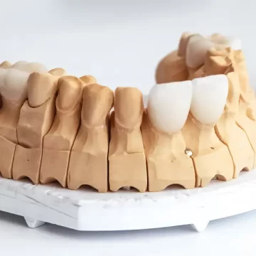 Do Veneers Hurt? The Truth Liberty Hill Dentists Don’t Always Tell